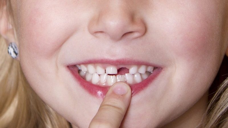 Mơ thấy gãy răng thường gắn với những con số may mắn nào?